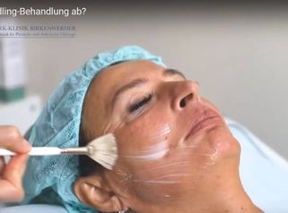 Wie läuft die Needling-Behandlung ab?